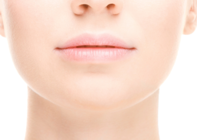 Fractional Non-Ablative Laser Resurfacing