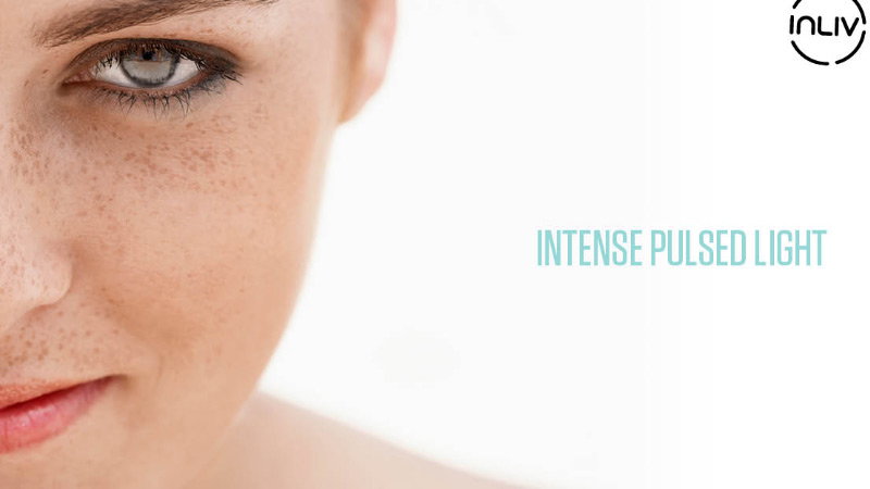 Get Rid of Sun Spots on Your Skin with IPL