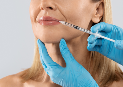 Tips To Reduce Bruising From Injectable Treatments
